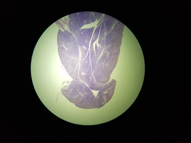 Pancreas Slides - Pancreas 002 40X